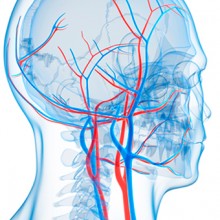 patologia_arterial_ivei_cadiz