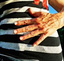 sindrome congestion pelvica Síndrome congestión pélvica