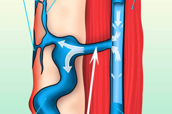 esquema-vena-perforante-911x1024