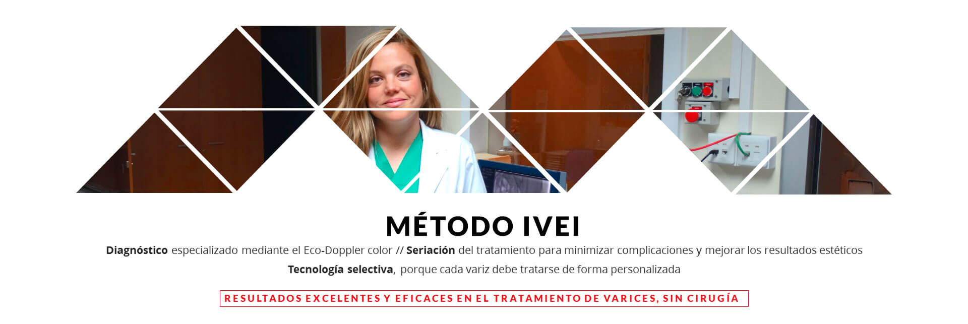 Metodo IVEI eliminacion de varices